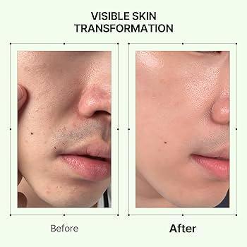 orien mugwort pore serum Image 4.jpeg