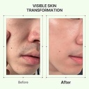 orien mugwort pore serum Image 4.jpeg